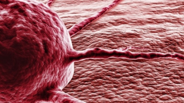 Rappresentazione virtuale di un tumore e come si presenta