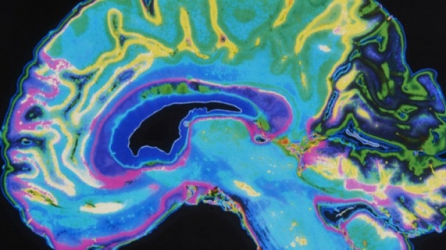 Gli scienziati hanno scoperto una proteina in grado di modificare l'attivit&agrave; cerebrale e la memoria senza l'aiuto di farmaci