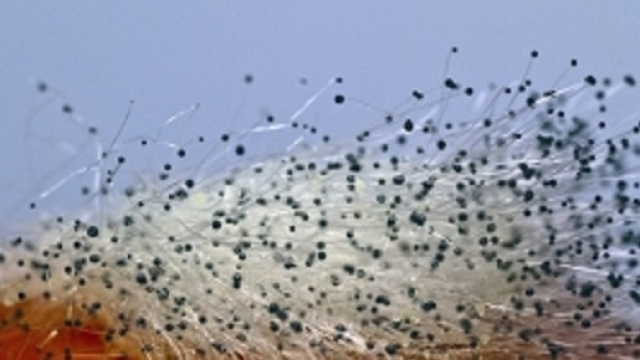 Le aspergillosi sono infezioni micotiche causate da miceti le cui spore fungine arrivano all'uomo via inalatoria.