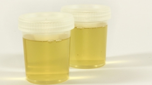 La nuova risorsa per l'energia elettrica e il combustibile per auto: la pip&igrave;.