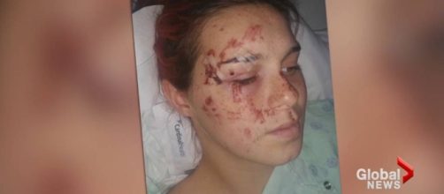 Pregnant &lsquo;Pokemon Go&rsquo; player hit by car, given emergency C-section to save baby