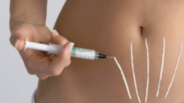 Basta Smagliature grazie alla biodermogenesi.