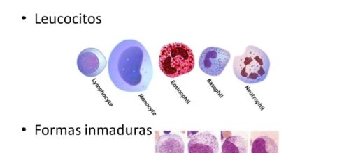Interpretaci&oacute;n del hemograma Dra. Jessica G&oacute;mez Pediatra ... - slideplayer.es
