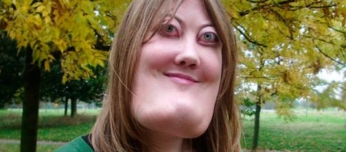 Rosto de mulher &eacute; considerado quatro ou cinco vezes maior que o tamanho de um rosto comum.