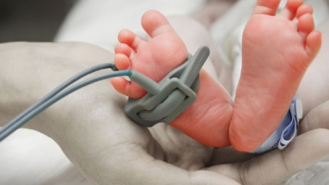 Bambini nati prematuri | Piedini bambino prematuro | FOTO ... - pianetamamma.it