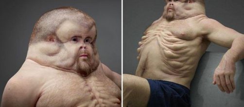 Graham, prot&oacute;tipo do ser-humano "inquebr&aacute;vel"