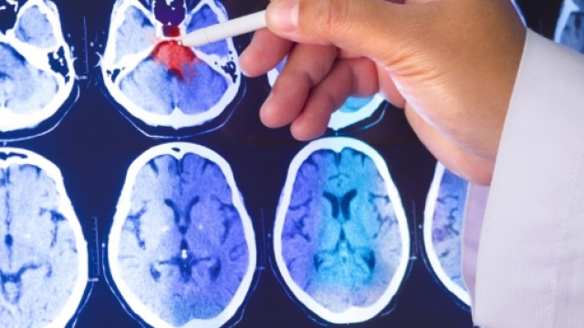 La ricerca medica punta la sua attenzione sui lavoratori notturni: a rischio per l'insorgenza del cancro