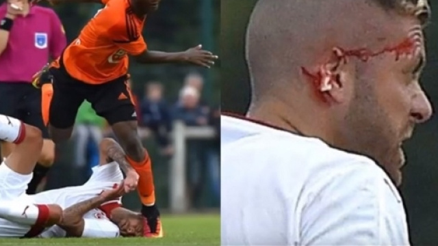 Menez e le foto dell'incidente