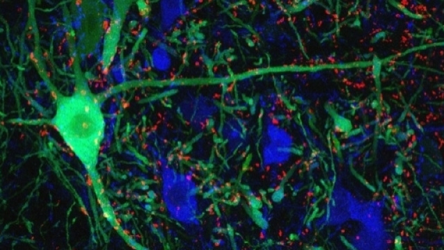 Neuroni motori del midollo spinale - Columbia University.