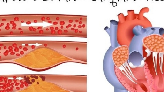 Una ricerca norvegese ha dimostarto che l'uomo, rispetto alla dona, corre un rischio maggiore di avere un infarto, a qualsiasi et&agrave;.