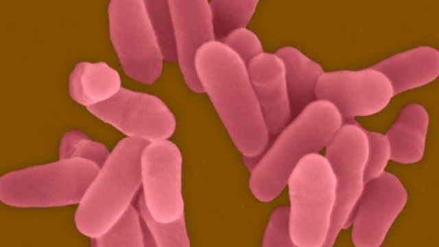 La tubercolosi uccide come l'Hiv - Wired - wired.it