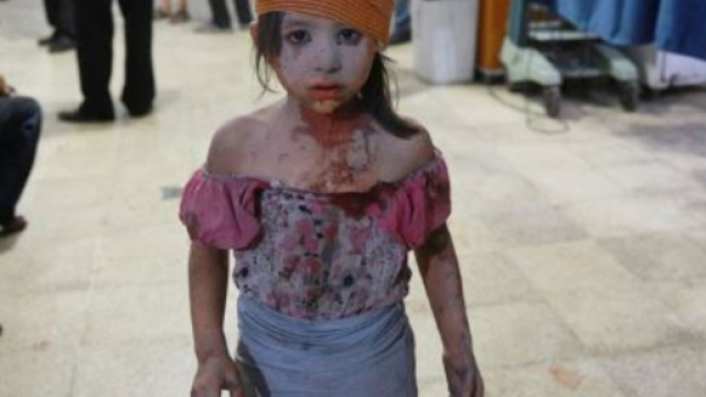 Vittime innocenti dell'assurda guerra Siriana