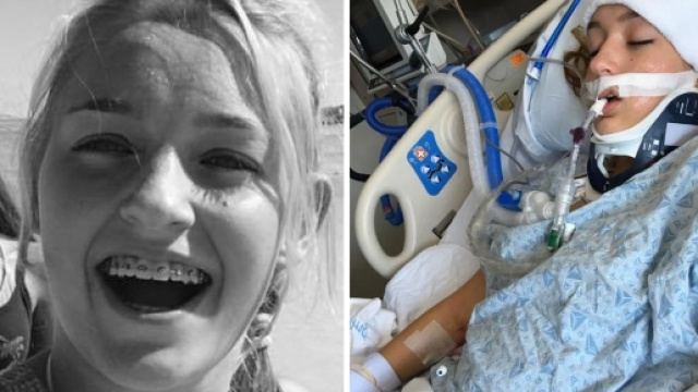 Usa, 15enne in coma etilico: madre posta foto su Facebook
