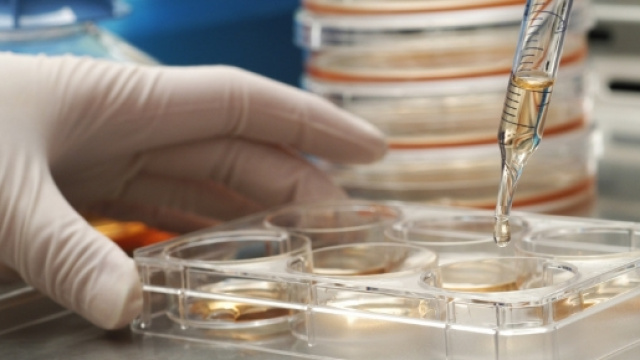 Sclerosi multipla: una nuova terapia basata su cellule staminali ... - cellulestaminalicordoneombelicale.it