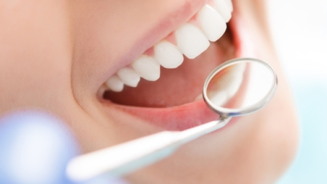 Denti antibatterici in 3D per combattere le carie | Benessere ... - leonardo.it