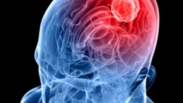 meningite-2.jpg - blitzquotidiano.it