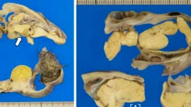 Scioccante ritrovamento nel ventre di una adolescente