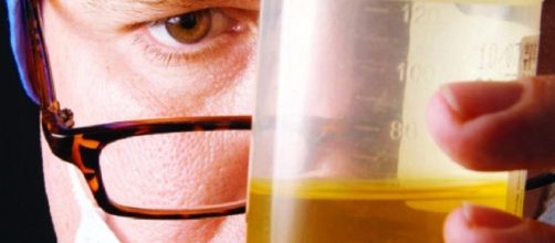 INCR&Iacute;VEL, doen&ccedil;a que causa mortes e urina escura chega ao Cear&aacute; e deixa cearenses em alerta.