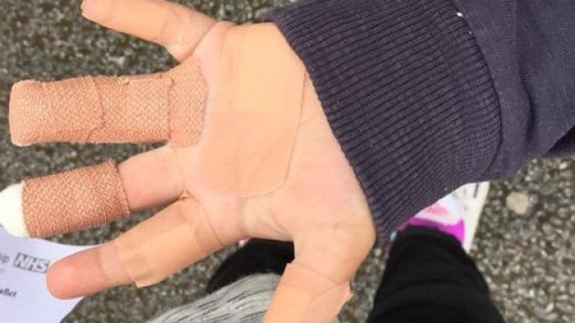Cornovaglia, scoiattoli grandi aggrediscono bimbo in un parco