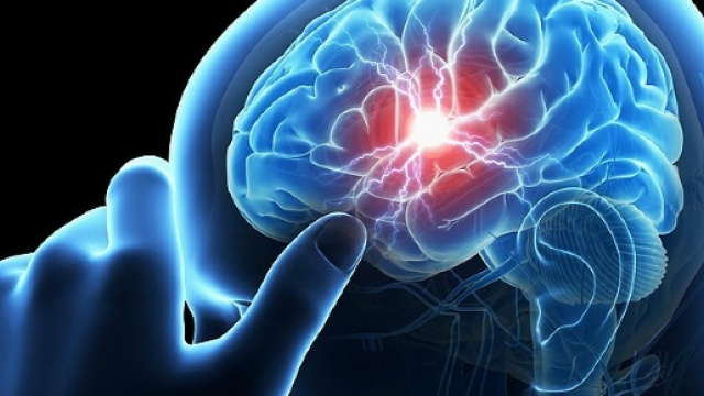 Ictus cerebrale, fino a 13 casi l'anno su 100mila bambini - DIRE.it - dire.it