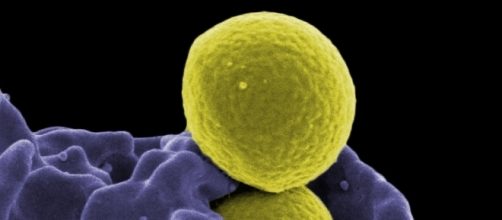 MRSA bacteria courtesy NIAID, flickr.com, government image CC0