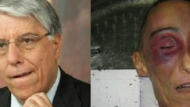Secondo Carlo Giovanardi Stefano Cucchi sarebbe morto per colpa della droga e non delle percosse