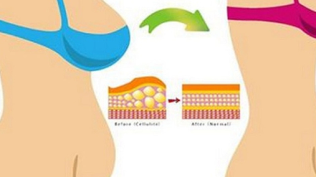Attenzione alla Flora batterica intestinale se vuoi perdere peso