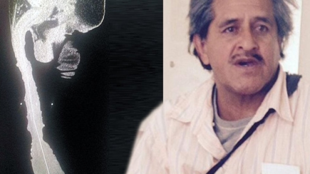 Ha il pene pi&ugrave; grande al mondo e non vuole rimpicciolirlo: la storia di Roberto