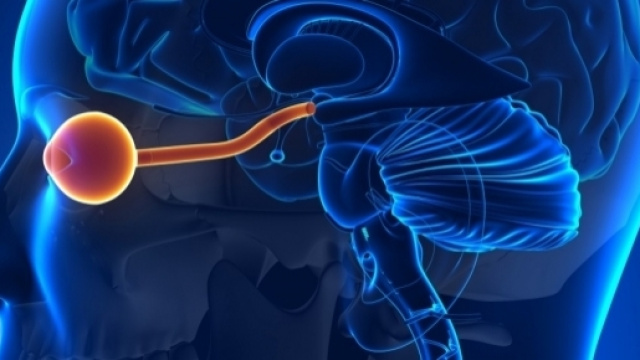 Il nervo ottico va incontro a infiammazione nella sclerosi multipla.