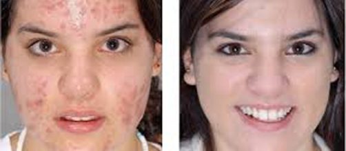 Impressionante: a verdade sobre o que o sabonete faz com a sua pele