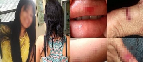 Professora espancada e torturada por 5 pessoas de uma mesma fam&iacute;lia.