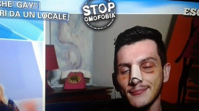 Il giovane picchiato a Milano intervistato a Pomeriggio 5