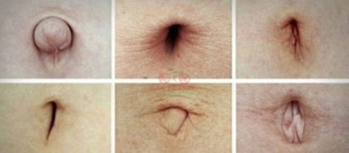 Veja quais os formatos de umbigos podem demonstrar que uma pessoa possui problemas de sa&uacute;de.