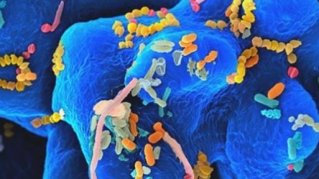 Il microbiota intestinale influenza il processo di carcinogenesi.