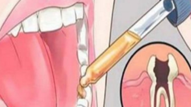 Evitare il dentista con un medicinale anti Alzheimer