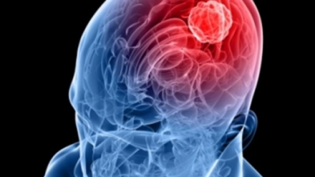 Meningite, infezione e terapia