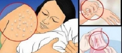 Confira alguns sintomas do HIV