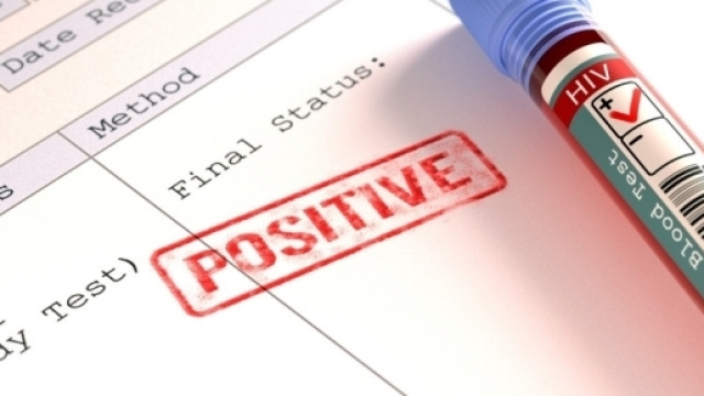 Tre persone positive all'Hiv dopo un test della saliva: l'esame del sangue &egrave; comunque l'unico affidabile al 100% - thesun.co.uk