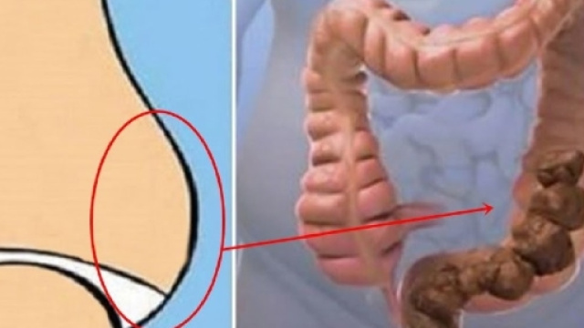 Risolvi i problemi all'intestino con dieci tipi di cibi