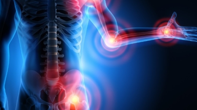 Il punto sulle malattie reumatiche