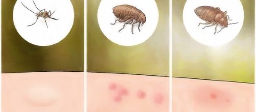 Cada inseto provoca uma rea&ccedil;&atilde;o diferente no corpo