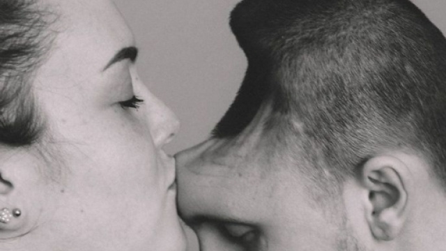 Abuso di energy drink, subisce un'operazione al cervello