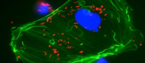 Scientists have studied techniques to assess the foodborne infection listeriosis (Image Institut Pasteur/Twitter).