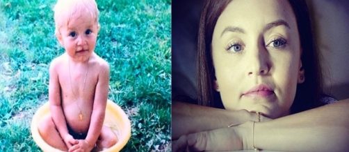 Atriz publicou uma foto onde mostra como era seus l&aacute;bios (Fotos: Instagram/Televisa)