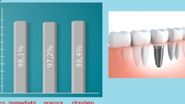 Le moderne tecniche di implantologia sono molto efficace, quelle a carico precoce preservano meglio il livello di osso peri-impianto.