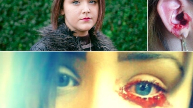 Sudare sangue: accade ad una ragazza italiana di Firenze.