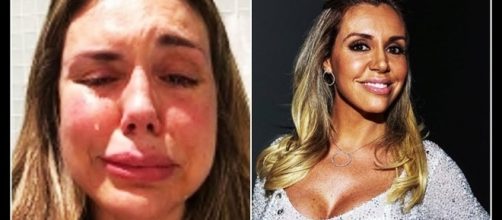 Renata Banhara ficar&aacute; quase um ano tentando se curar (Foto: Reprodu&ccedil;&atilde;o/Instagram)