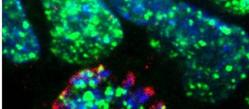 Roturas del ADN (puntos verdes) en el n&uacute;cleo de c&eacute;lulas tratadas con quimioterapia