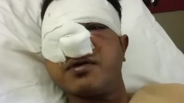 Il bengalese pestato sabato notte da una banda di ragazzi tra 17 e 19 anni, sentito nel suo letto d'ospedale. Foto: Messaggero Tv.