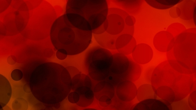 Stimmate ed ematoidrosi, il caso italiano della malattia che fa ... - wired.it